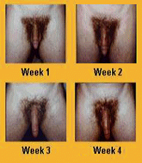 Is Penis Enlargement True 81